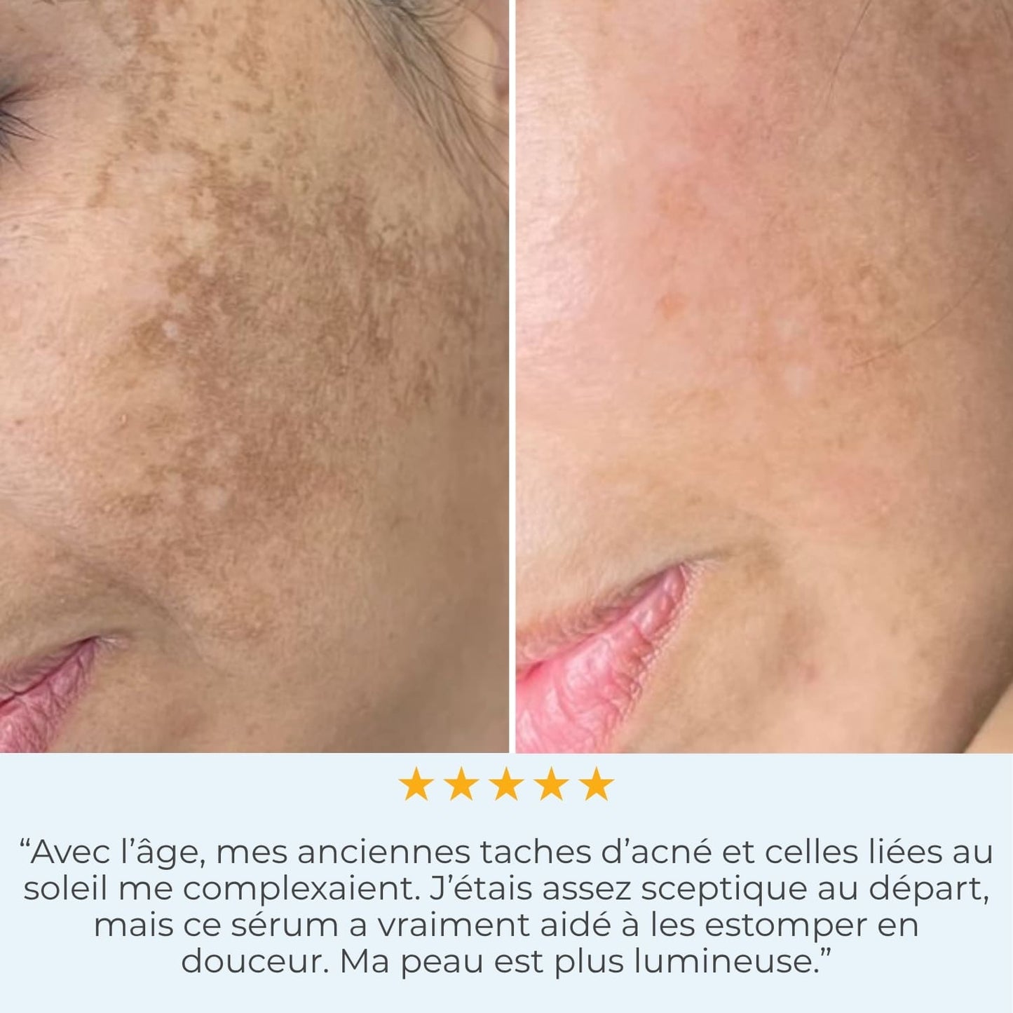 Luminate Face Sérum