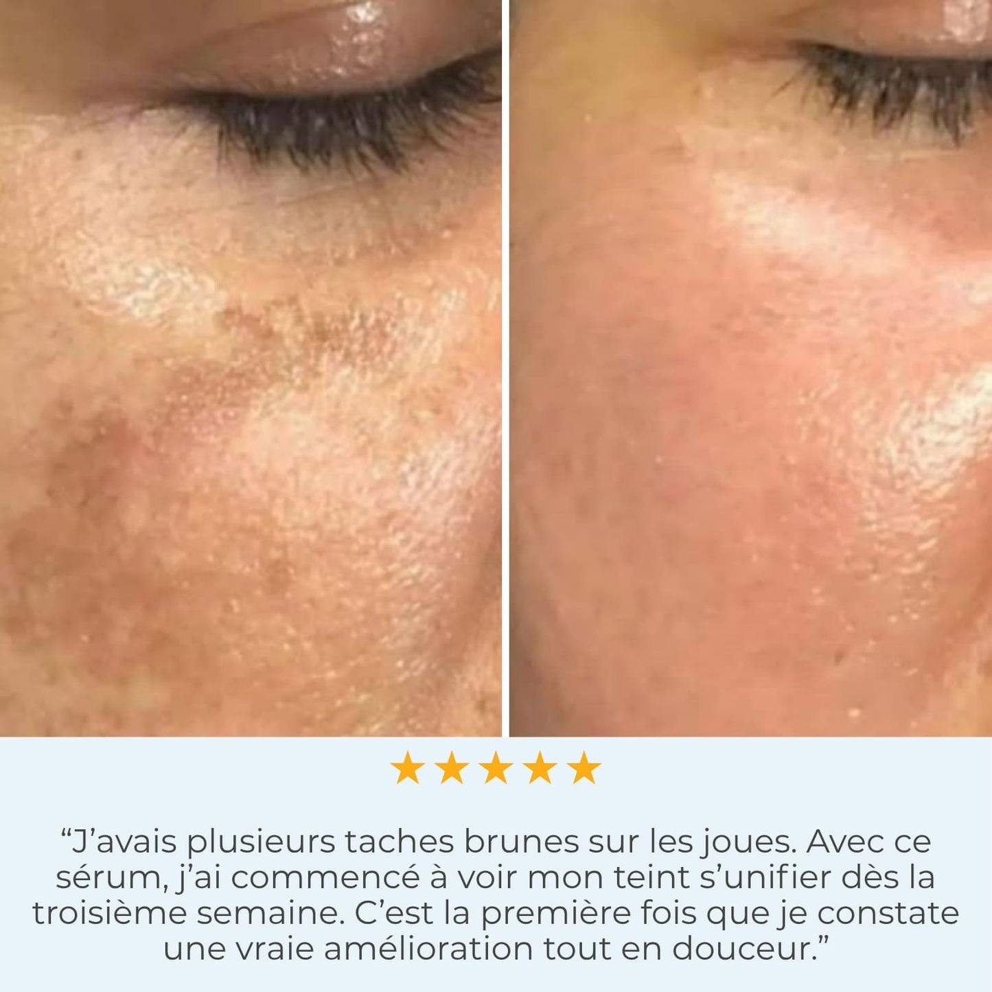 Luminate Face Sérum