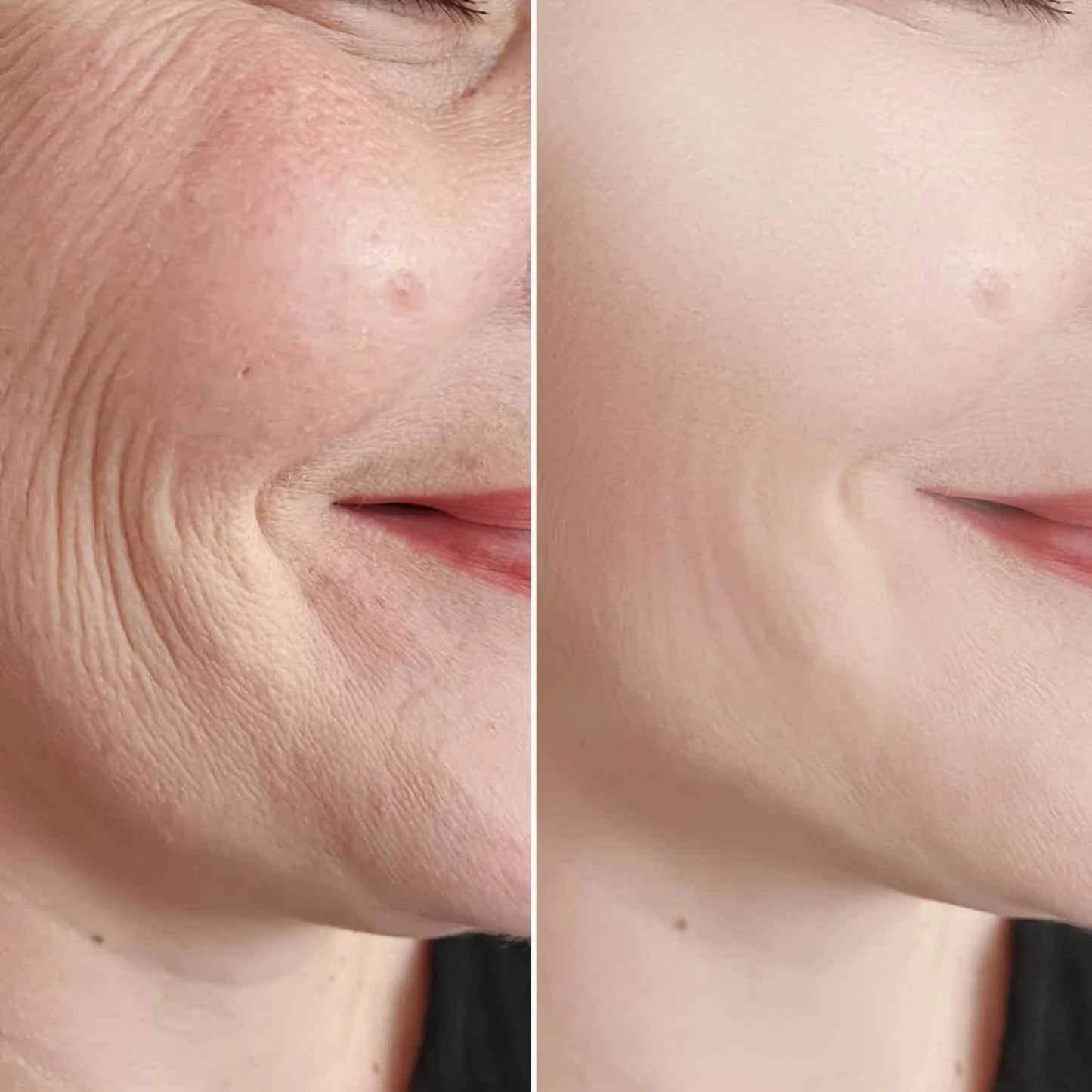 Glowskin Pro® - Máscara LED Antiedad