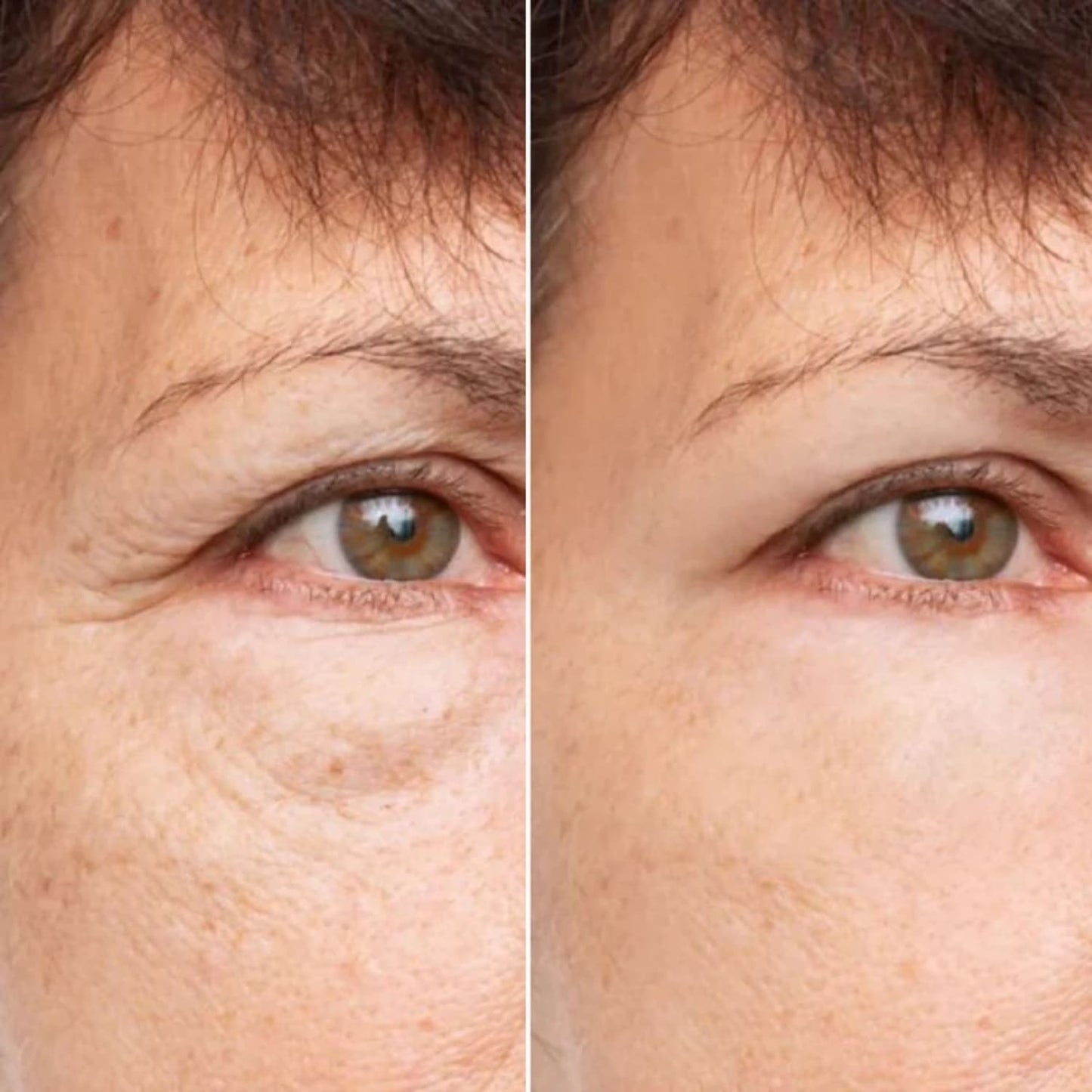 Glowskin Pro® - Máscara LED Antiedad