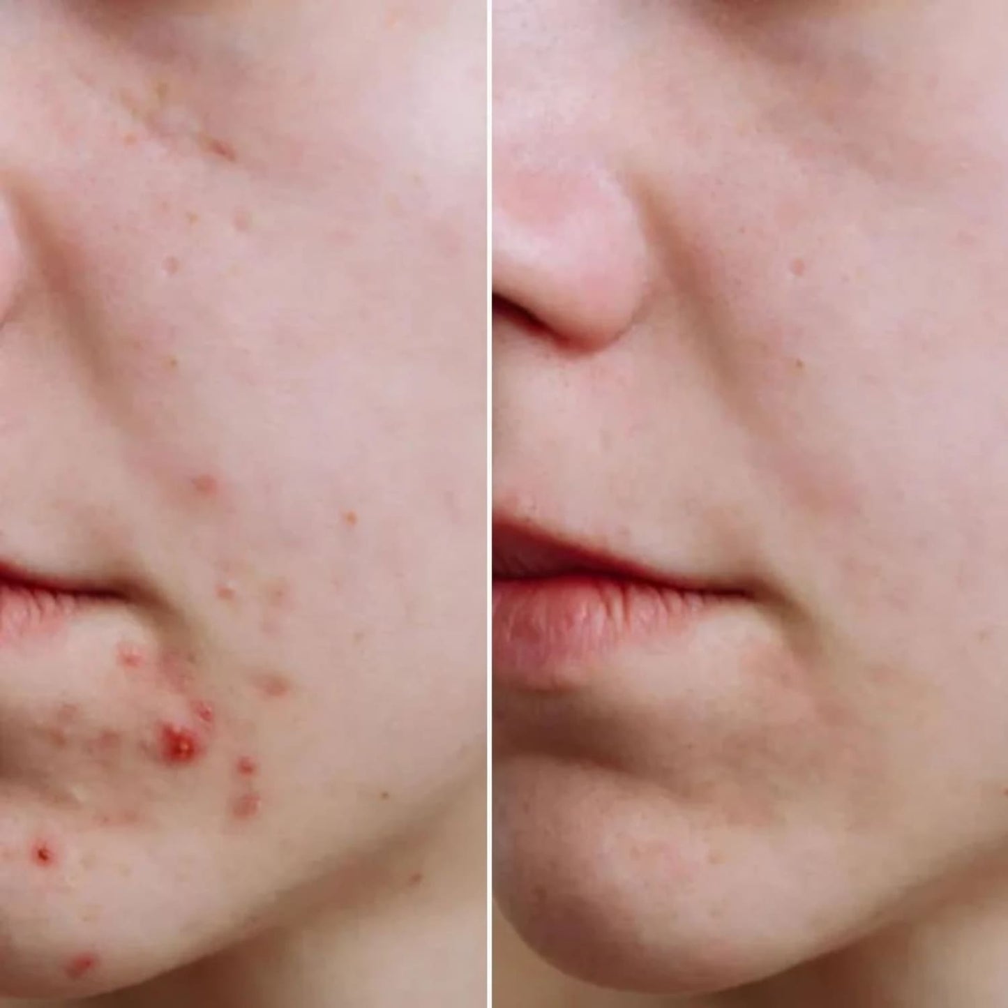 Glowskin Pro® - Máscara LED Antiedad