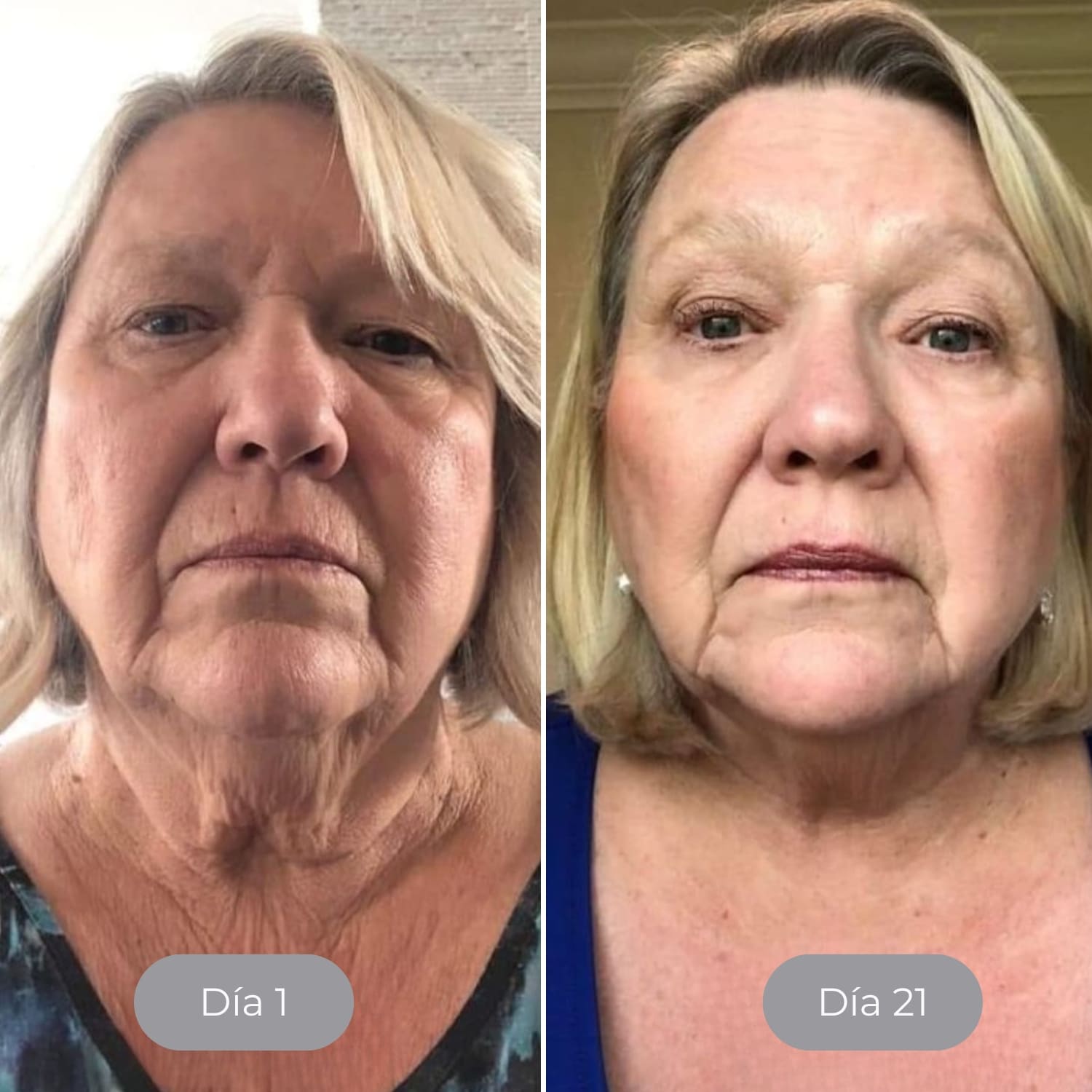 Luminate Face Serum Vitamina C